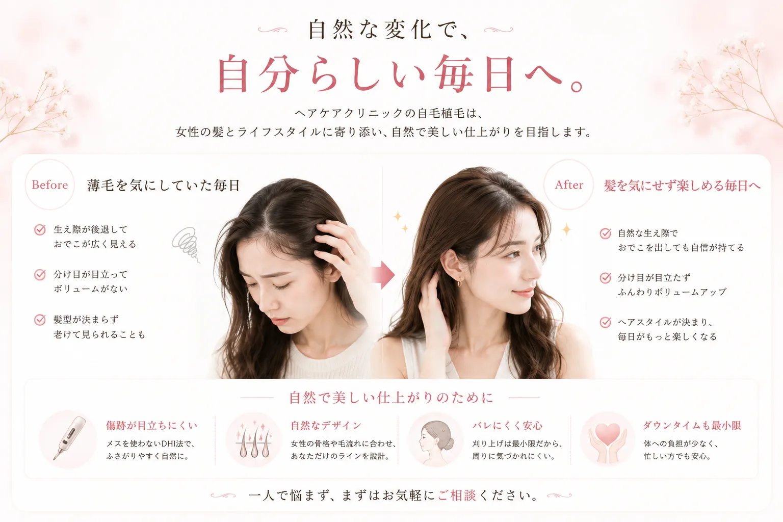 自毛植毛による変化のイメージ Before After